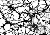 neurons-autism 